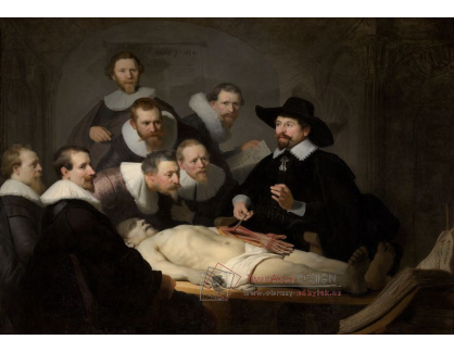 R4-2 Rembrandt - Lekce anatomie doktora Tulpa