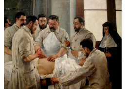 SO V-187 Vicente Castell - Laparotomie